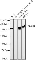 PLA2R1 Antibody in Western Blot (WB)