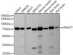 PRMT7 Antibody in Western Blot (WB)