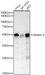 SESN2 Antibody in Western Blot (WB)