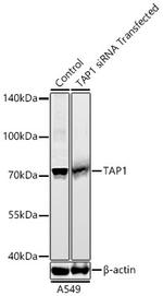 TAP1 Antibody in Western Blot (WB)