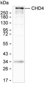 CHD4 Antibody in Western Blot (WB)