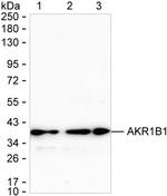 AKR1B1 Antibody in Western Blot (WB)