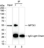 NPTX1 Antibody in Immunoprecipitation (IP)