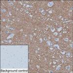 Synaptotagmin 1 Antibody in Immunohistochemistry (Paraffin) (IHC (P))