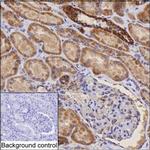 DLAT Antibody in Immunohistochemistry (Paraffin) (IHC (P))