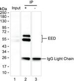 EED Antibody in Immunoprecipitation (IP)