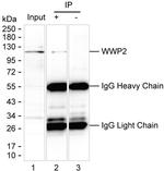 AIP2 Antibody in Immunoprecipitation (IP)