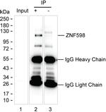 ZNF598 Antibody in Immunoprecipitation (IP)