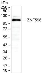 ZNF598 Antibody in Western Blot (WB)