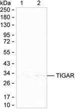 TIGAR Antibody in Western Blot (WB)