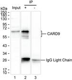 CARD9 Antibody in Immunoprecipitation (IP)