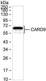 CARD9 Antibody in Western Blot (WB)