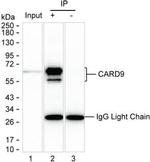 CARD9 Antibody in Immunoprecipitation (IP)