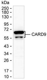 CARD9 Antibody in Western Blot (WB)