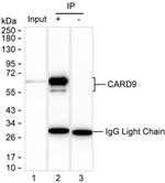 CARD9 Antibody in Immunoprecipitation (IP)