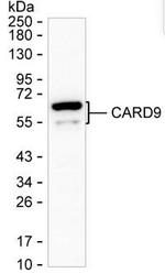 CARD9 Antibody in Western Blot (WB)