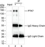 PTK7 Antibody in Immunoprecipitation (IP)