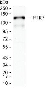 PTK7 Antibody in Western Blot (WB)