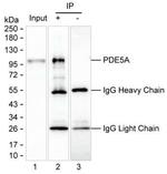 PDE5 Antibody in Immunoprecipitation (IP)