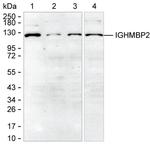 IGHMBP2 Antibody in Western Blot (WB)