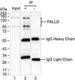 Palladin Antibody in Immunoprecipitation (IP)