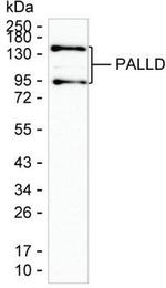 Palladin Antibody in Western Blot (WB)