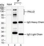 Palladin Antibody in Immunoprecipitation (IP)