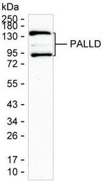 Palladin Antibody in Western Blot (WB)