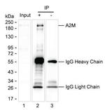 A2M Antibody in Immunoprecipitation (IP)