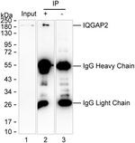 IQGAP2 Antibody in Immunoprecipitation (IP)