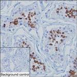 TRAFD1 Antibody in Immunohistochemistry (Paraffin) (IHC (P))