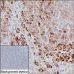 ASPM Antibody in Immunohistochemistry (Paraffin) (IHC (P))