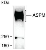 ASPM Antibody in Western Blot (WB)