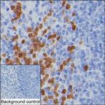 CDA Antibody in Immunohistochemistry (Paraffin) (IHC (P))