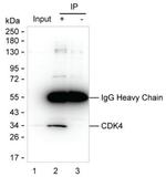 CDA Antibody in Immunoprecipitation (IP)