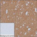 SNAP25 Antibody in Immunohistochemistry (Paraffin) (IHC (P))