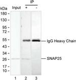 SNAP25 Antibody in Immunoprecipitation (IP)