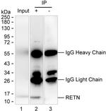 Resistin Antibody in Immunoprecipitation (IP)