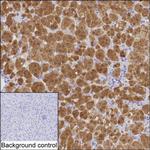 AKR1B1 Antibody in Immunohistochemistry (Paraffin) (IHC (P))