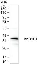 AKR1B1 Antibody in Western Blot (WB)