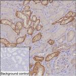 MTHFD2 Antibody in Immunohistochemistry (Paraffin) (IHC (P))