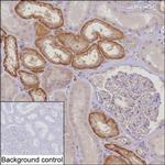 MTHFD2 Antibody in Immunohistochemistry (Paraffin) (IHC (P))