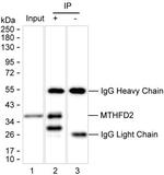 MTHFD2 Antibody in Immunoprecipitation (IP)