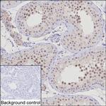 NSMCE1 Antibody in Immunohistochemistry (Paraffin) (IHC (P))