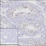 NSMCE1 Antibody in Immunohistochemistry (Paraffin) (IHC (P))