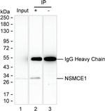 NSMCE1 Antibody in Immunoprecipitation (IP)