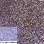 CD74 Antibody in Immunohistochemistry (Paraffin) (IHC (P))