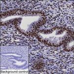 CHD4 Antibody in Immunohistochemistry (Paraffin) (IHC (P))