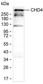 CHD4 Antibody in Western Blot (WB)