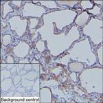 MDA5 Antibody in Immunohistochemistry (Paraffin) (IHC (P))